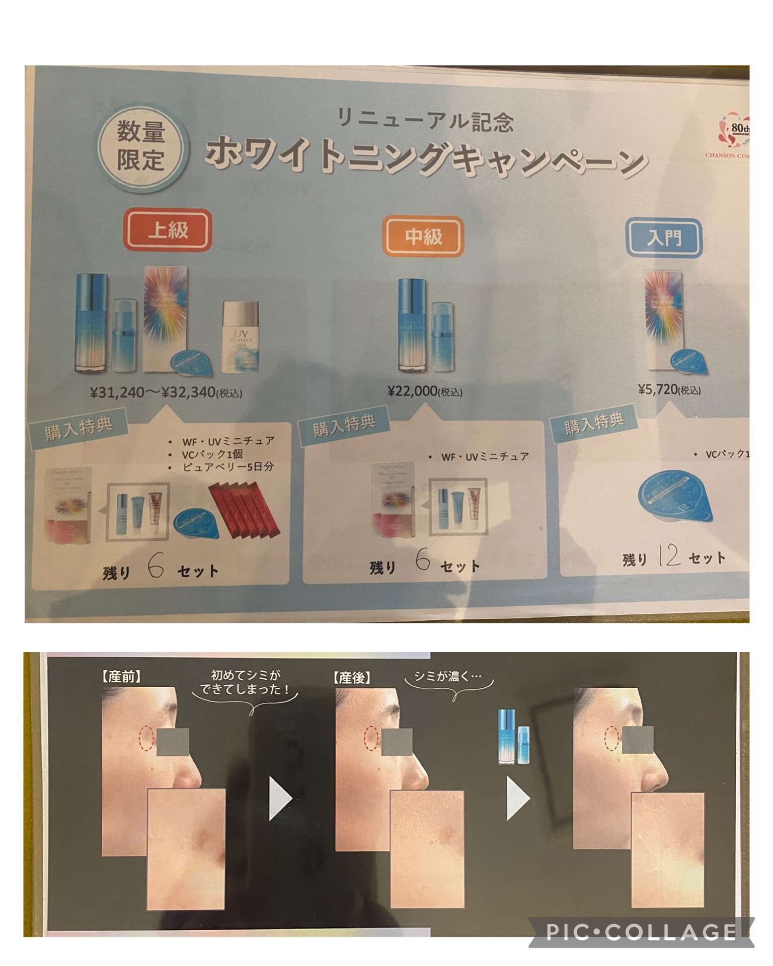 美白シリーズでました!
